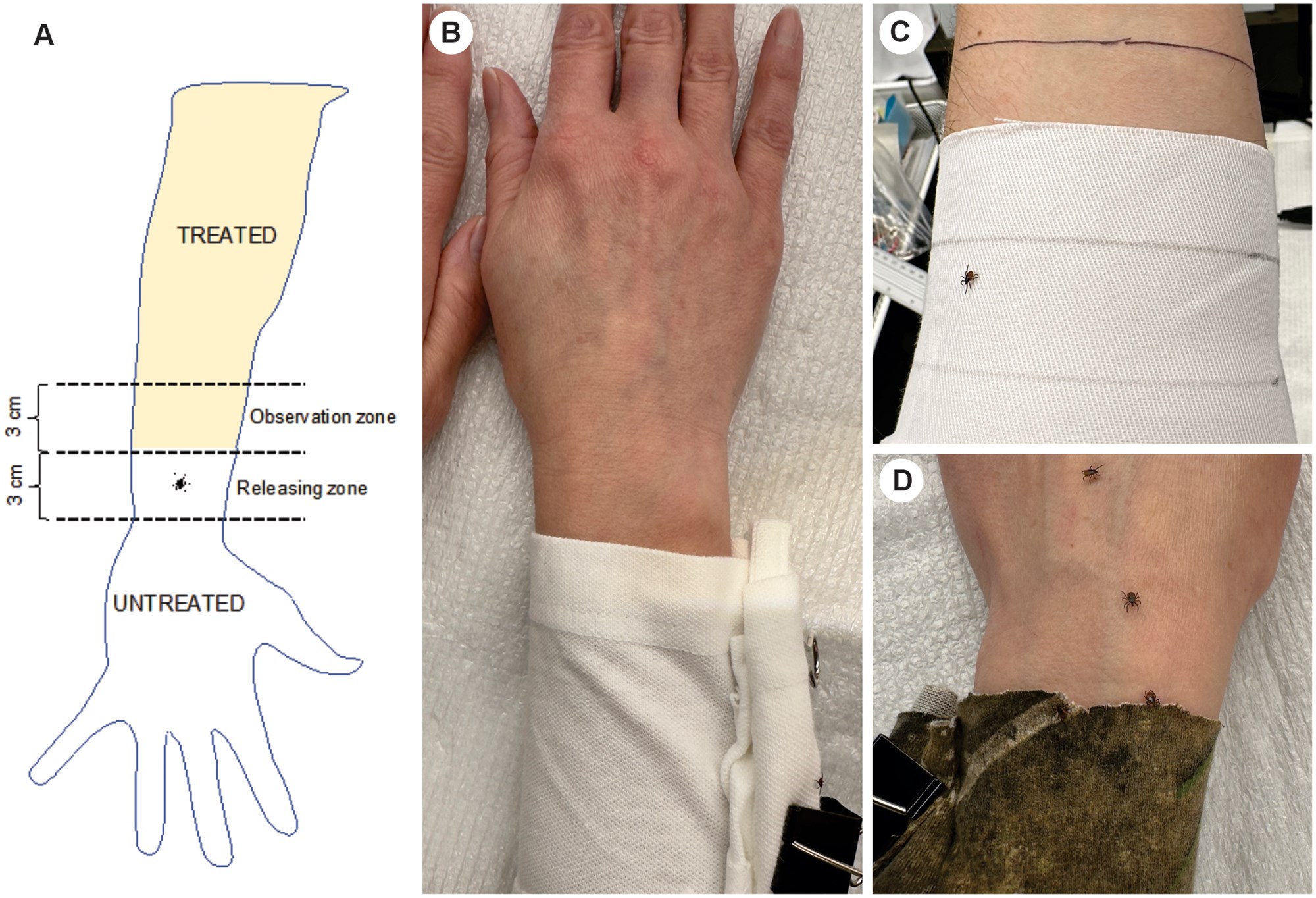 Repellent efficacy of a novel essential oil-based fabric spray formulation against <i>Ixodes scapularis</i> and <i>Dermacentor variabilis</i> ticks in laboratory conditions and human trials